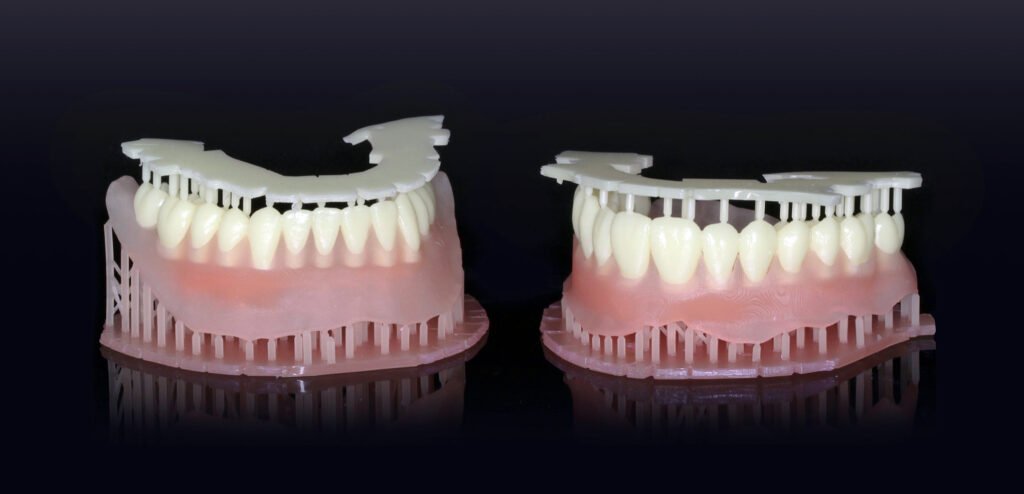 sprintray-by-august-oliveira-digital-enamel-3dprinted-denture-1024x494 Usos da Impressão 3D
